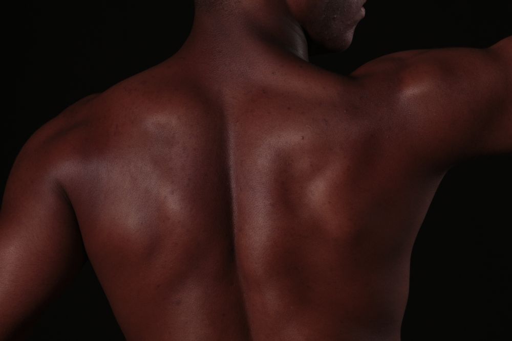 Dos lisse - épilation laser homme